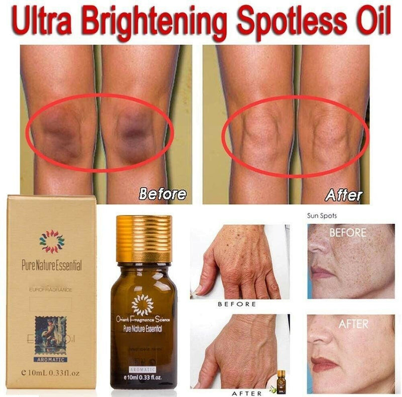 Ultra Brightening Spotless Oil Anti Dark Spots Natural Pure Oil Serum Skin 30ml