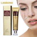 LANBENA Pimple Scar Acne Mark Spots Removal Treatment Gel Ointment Blemish Cream