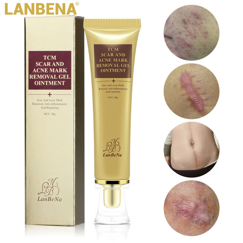 LANBENA Pimple Scar Acne Mark Spots Removal Treatment Gel Ointment Blemish Cream